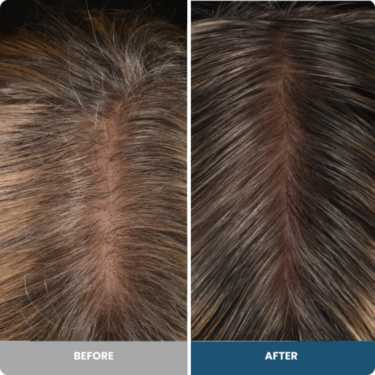 Before and after hair growth results