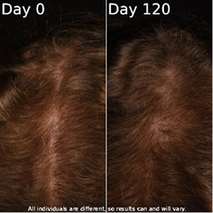 Hair texture comparison result showing day 120 progress