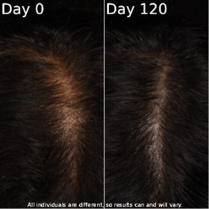 Hair texture comparison between day 0 and day 120