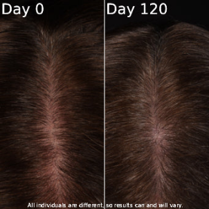 Customer hair progress result